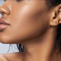 How Often Should You Get Facial Fillers?