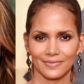 10 Celebrities Who Look Stunning After Getting Facial Fillers