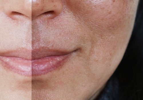 Does the filler accelerate aging?