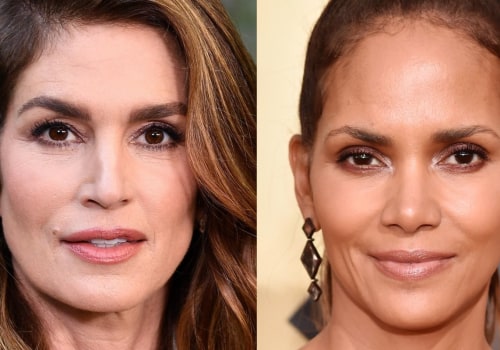 Which celebrities have had facial fillers?